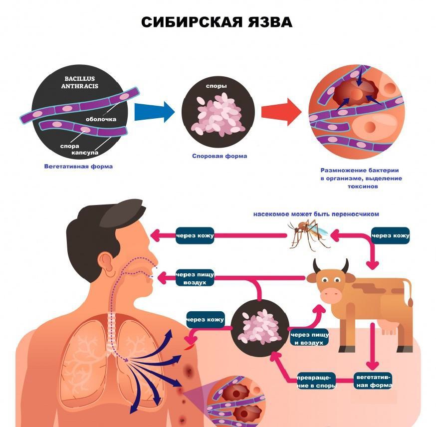 Сибирская язва – особо опасная инфекционная болезнь животных и человека..